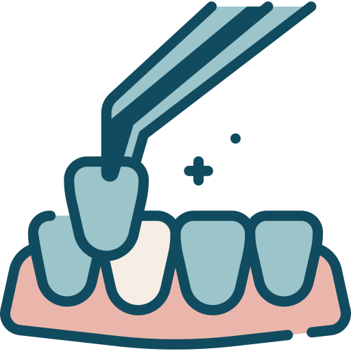 Temporary Veneers