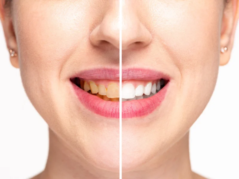 affordable emergency dentist