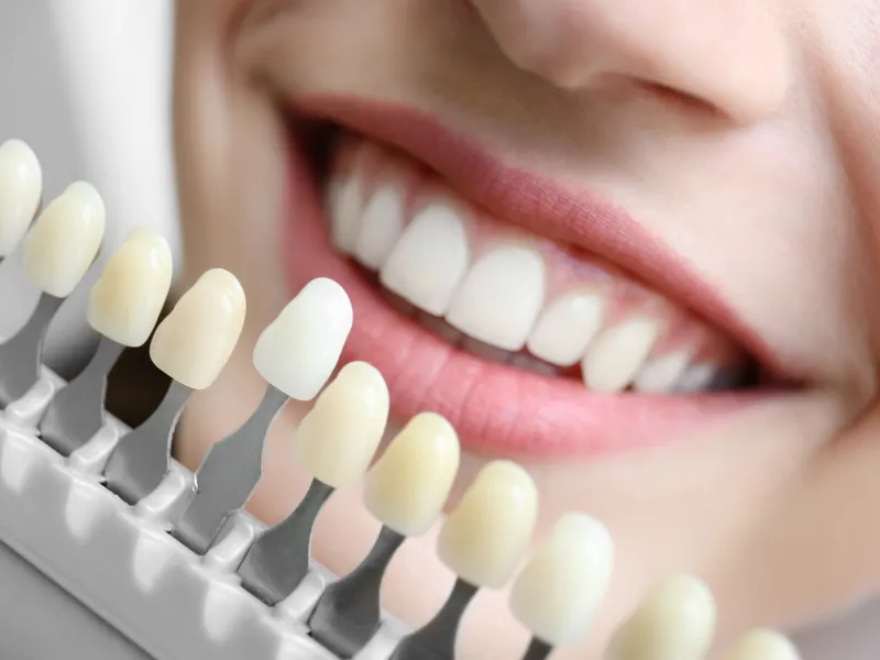 cosmetic dentistry