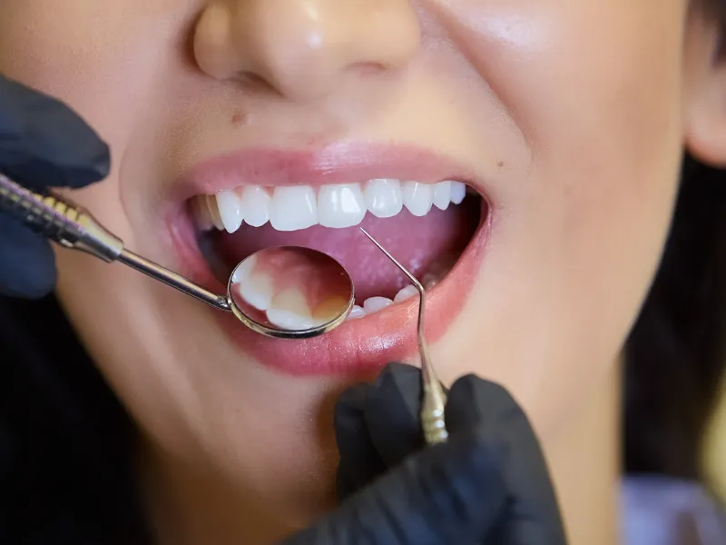 dental check up