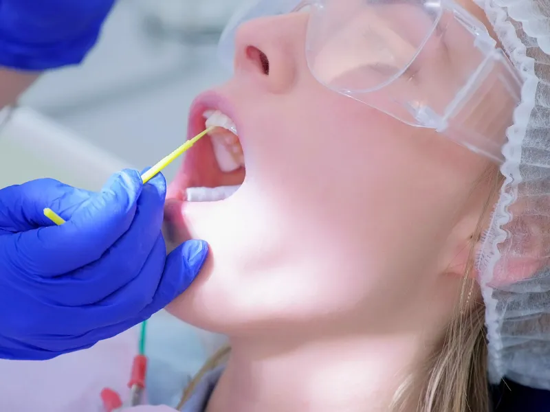 fluoride treatment