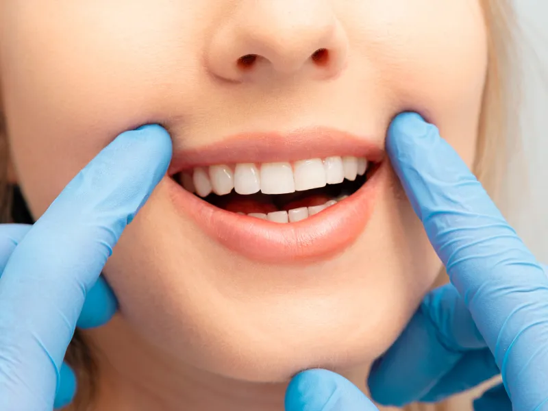 teeth whitening benefits