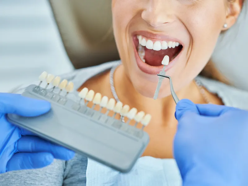 teeth whitening cost