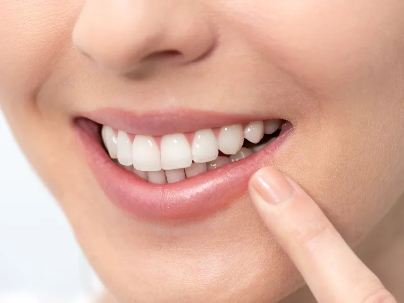 teeth whitening magnolia