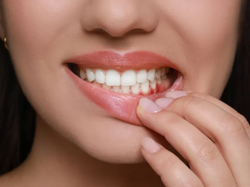tooth abscess treatment