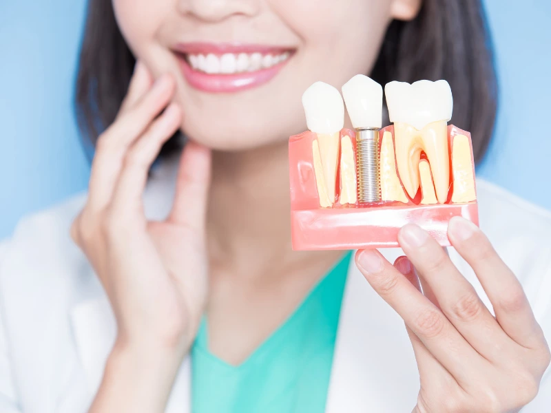 tooth implant aftercare