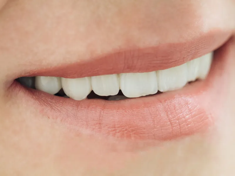 benefits of a dental bridge