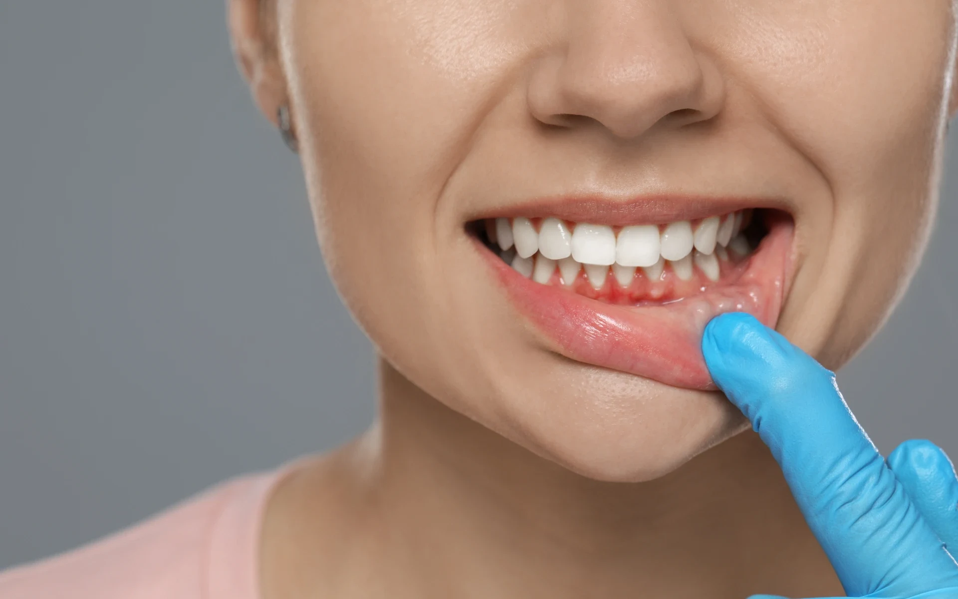 tooth abscess treatment magnolia
