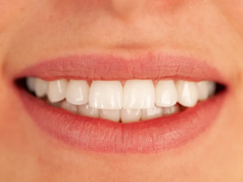 tooth extraction aftercare