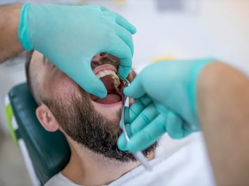 tooth extraction in magnolia, tx