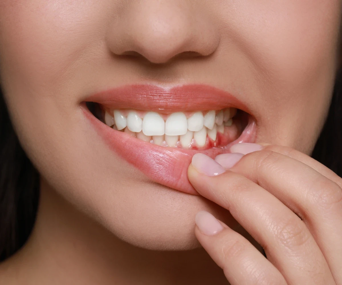 what is an abscess in tooth