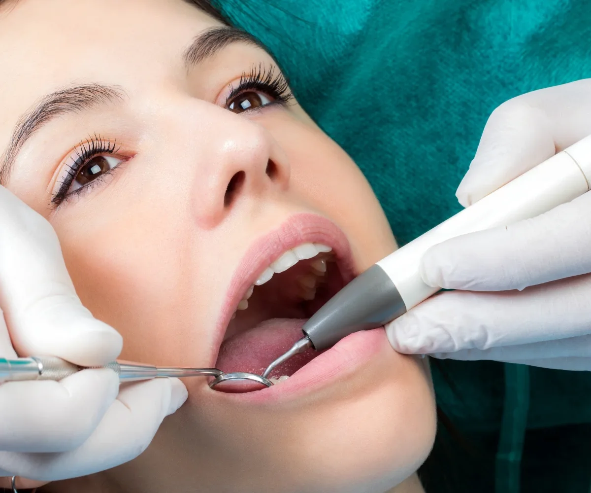 deep dental cleaning procedure