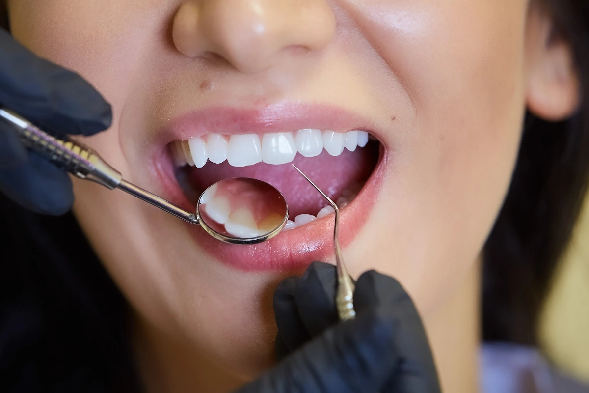 dental check up process