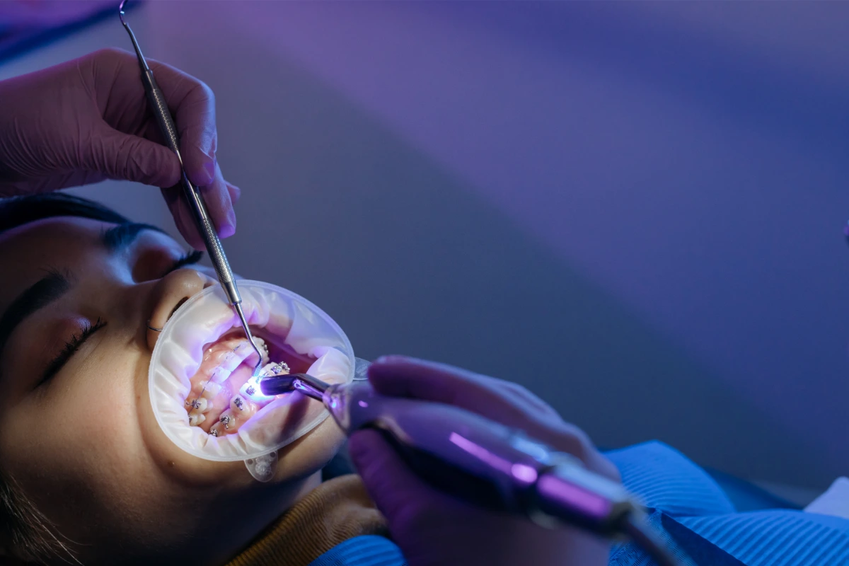 dental check ups benefits