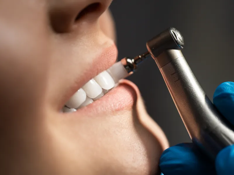 dental cleaning magnolia tx