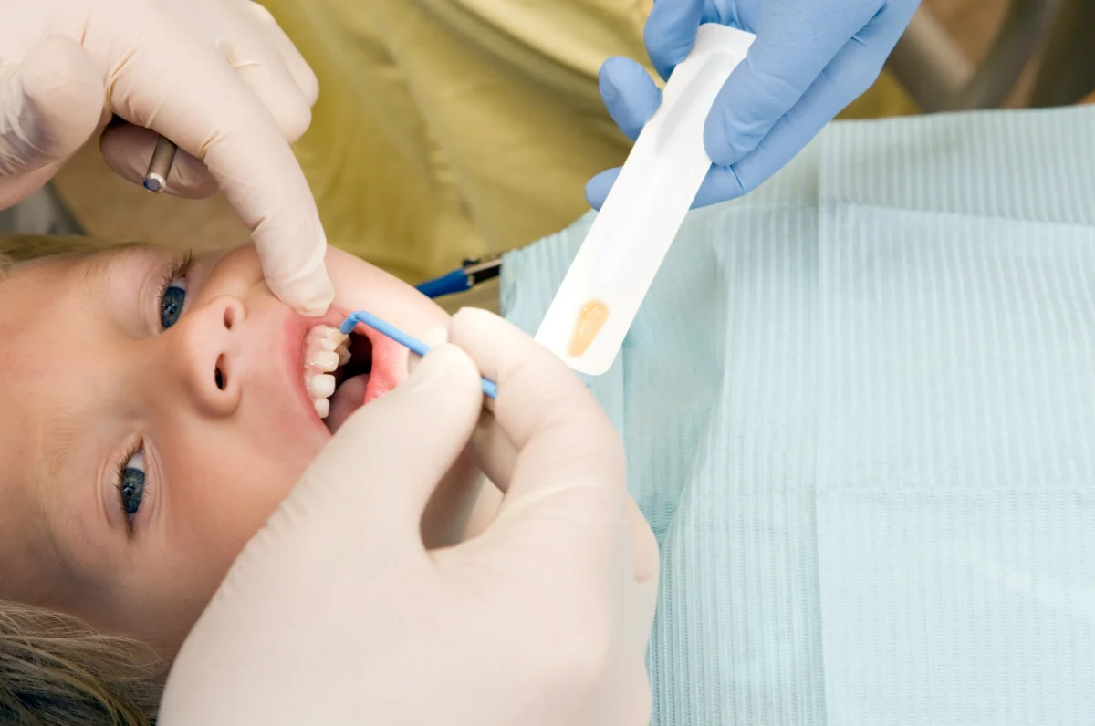 fluoride treatment magnolia tx