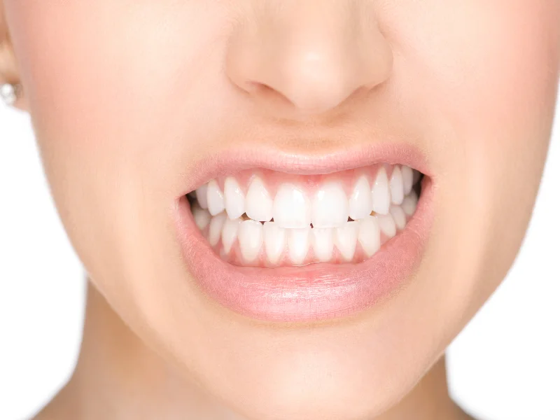 prevent gum bleeding