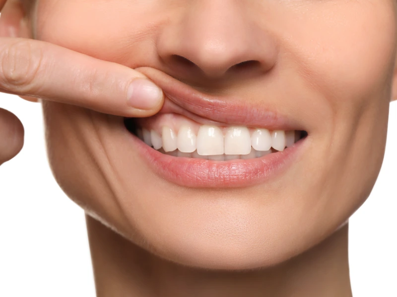 reduce swollen gums