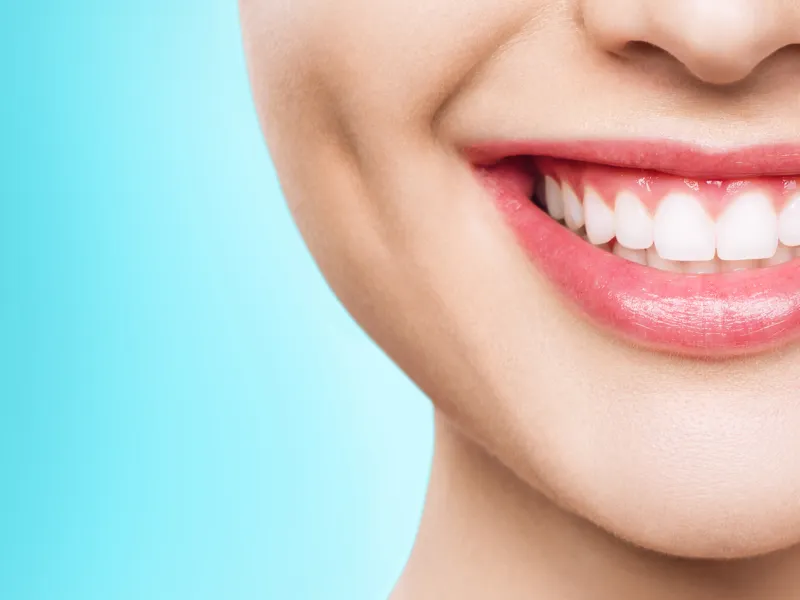 smile makeover magnolia tx