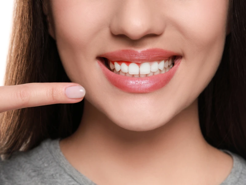 swollen gum relief