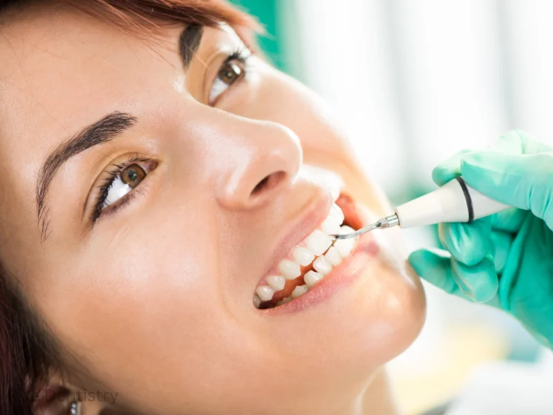 dental cleaning prices