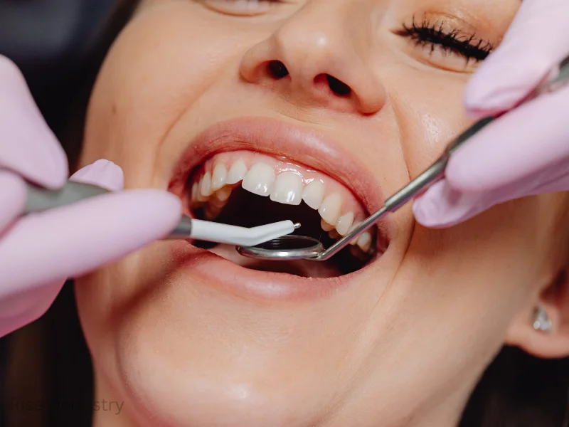 dental cleaning tips
