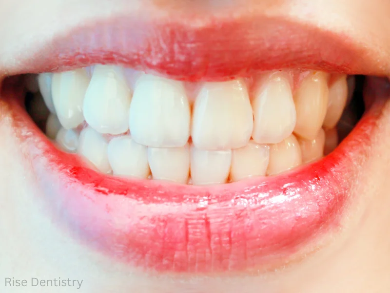 dentist for swollen gums