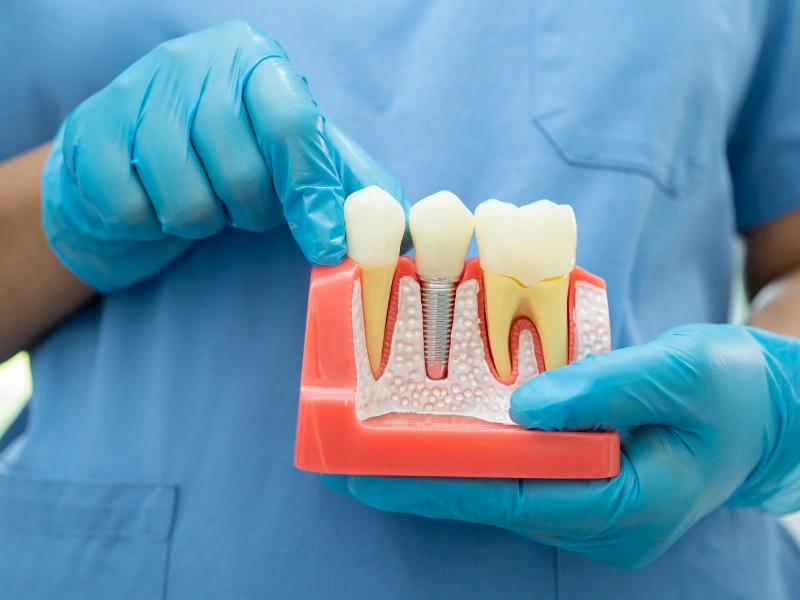 implant dentures costs