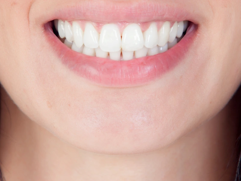 is deep cleaning teeth painful