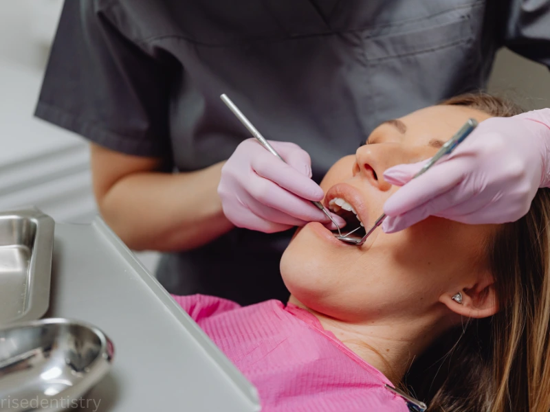 benefits of dental sealants treatment