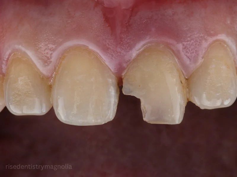 benefits of tooth care treatment
