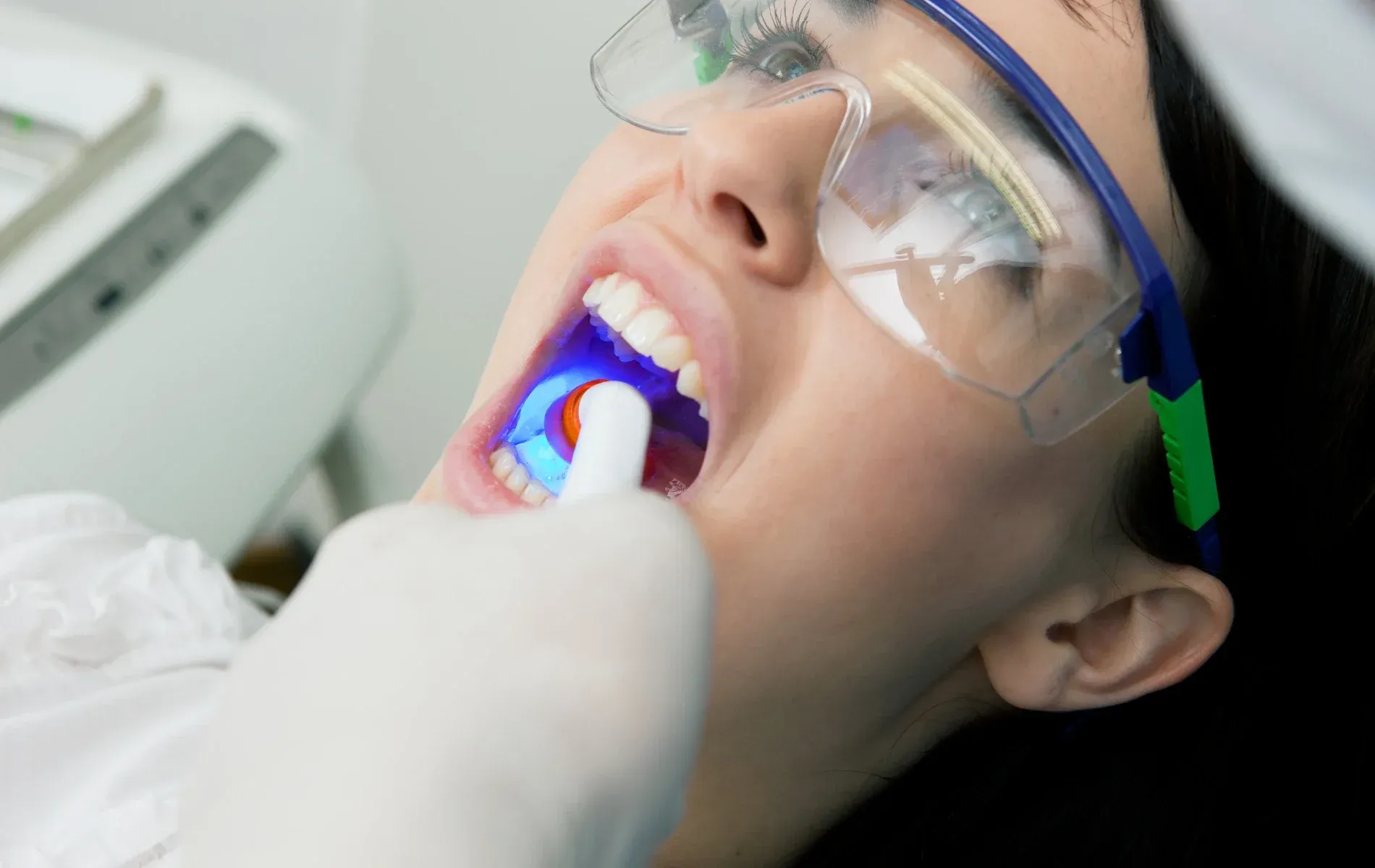 best deep dental cleaning