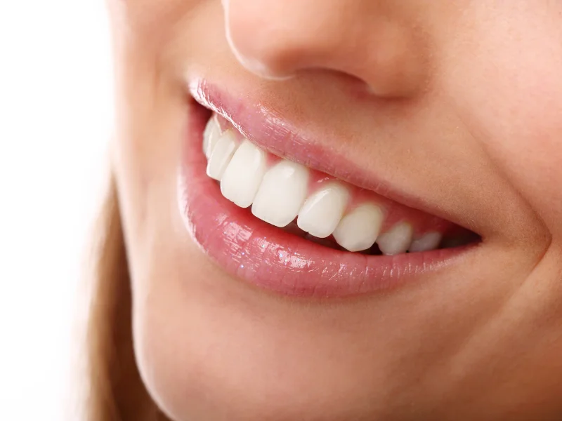 chipped tooth cost