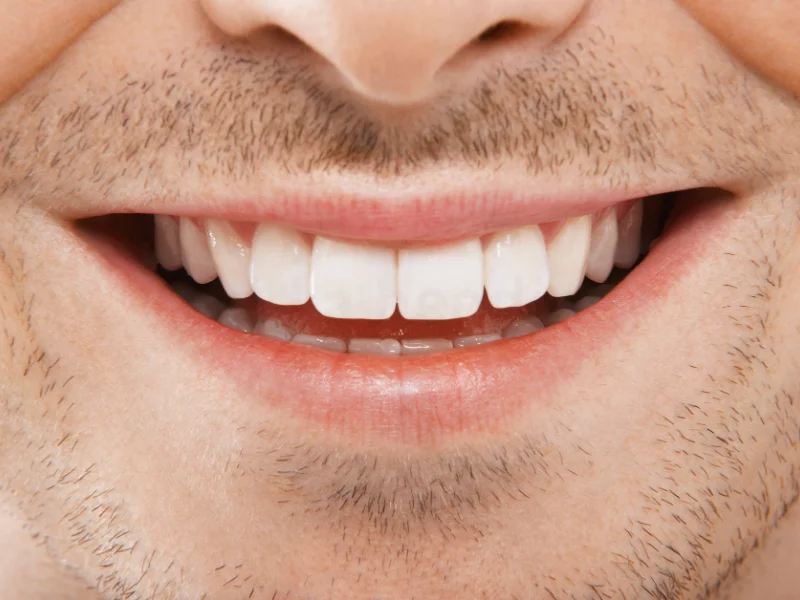 cost of fixing a cracked tooth