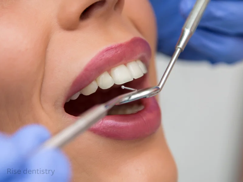 deep dental cleaning