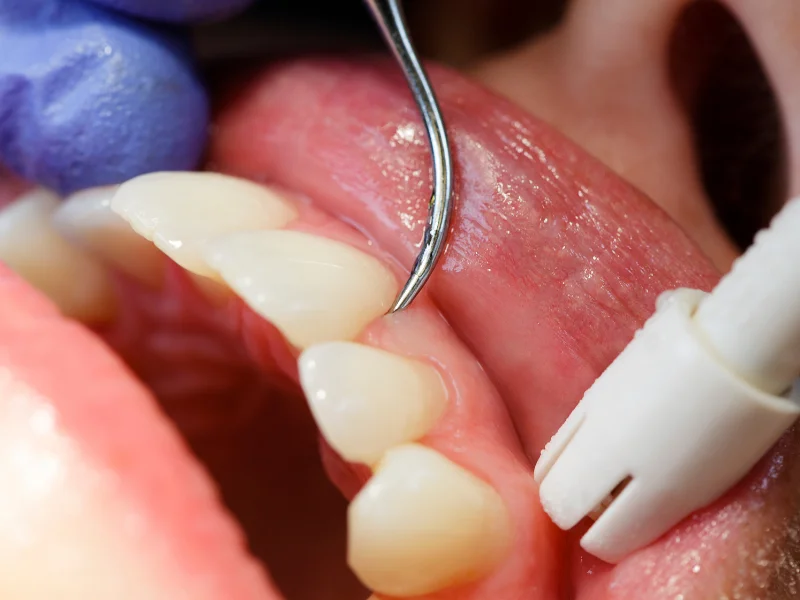 dental check up