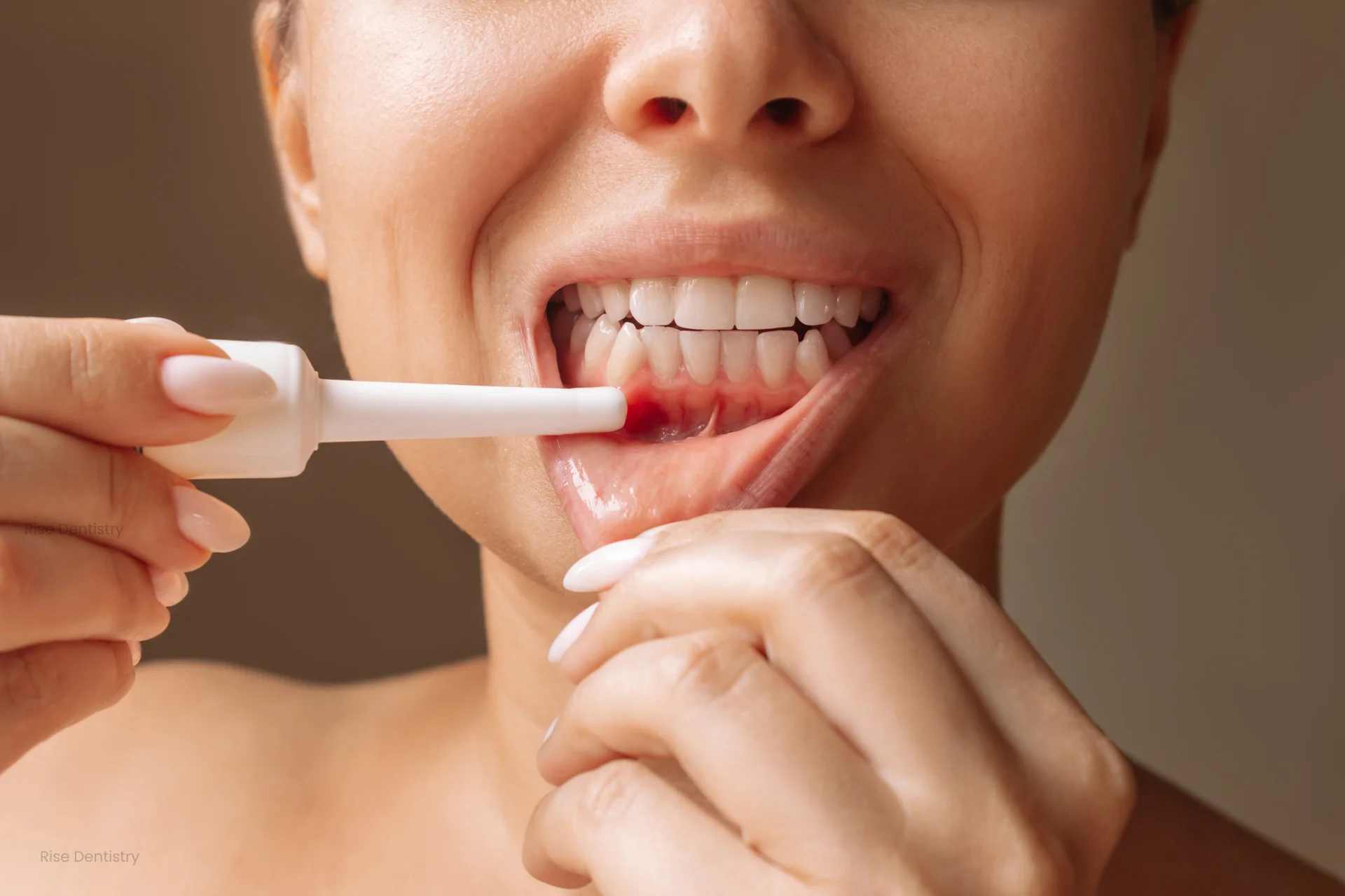 how to stop gum bleeding after dental cleaning
