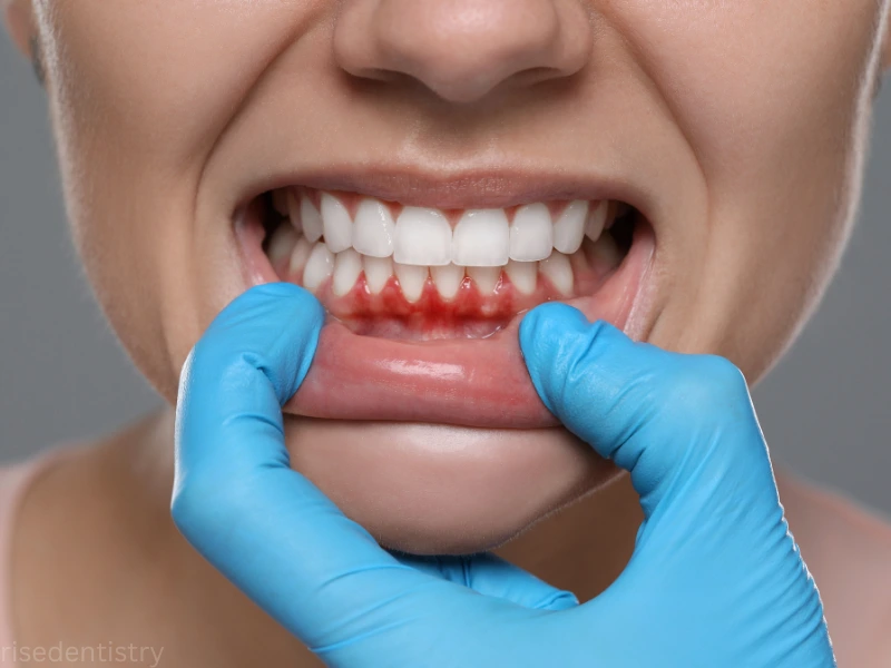 key benefits of dental abscess