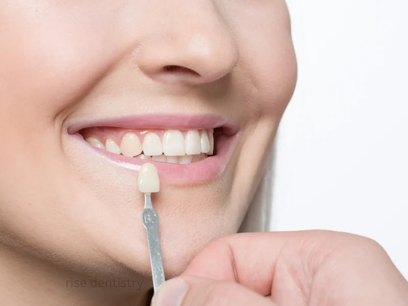 tooth crown procedure
