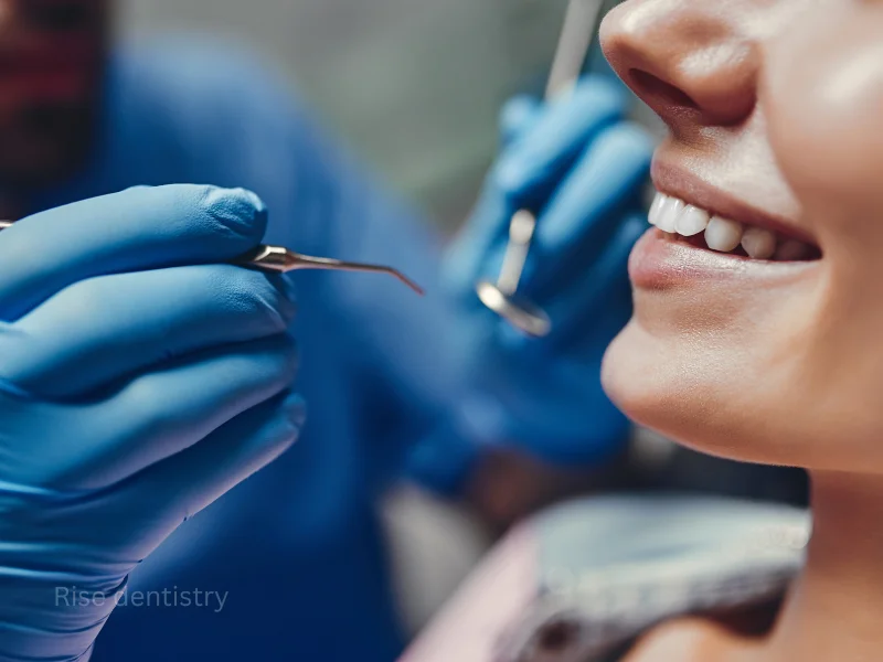 understanding the dental cleaning process