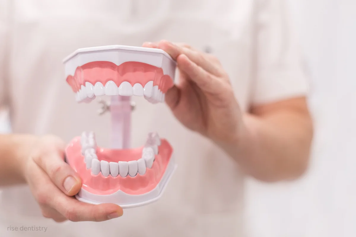 what are dentures