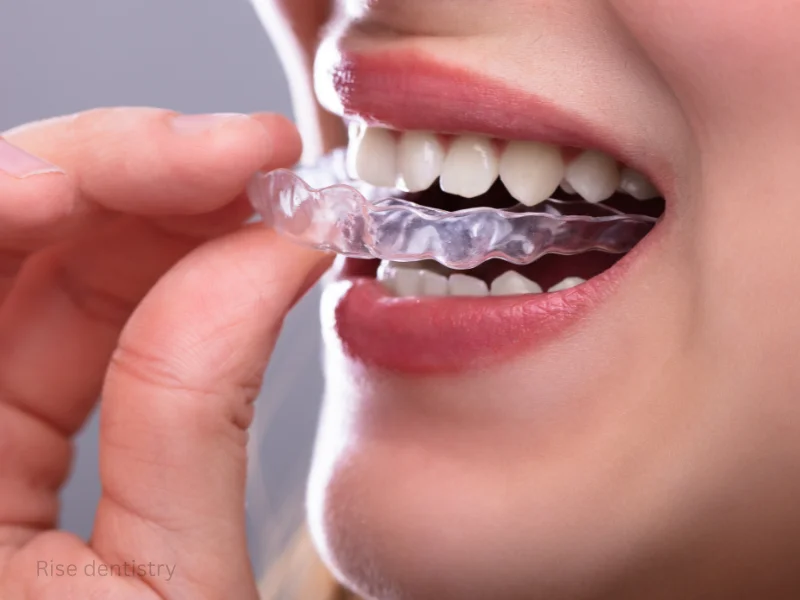 adult teeth straightening