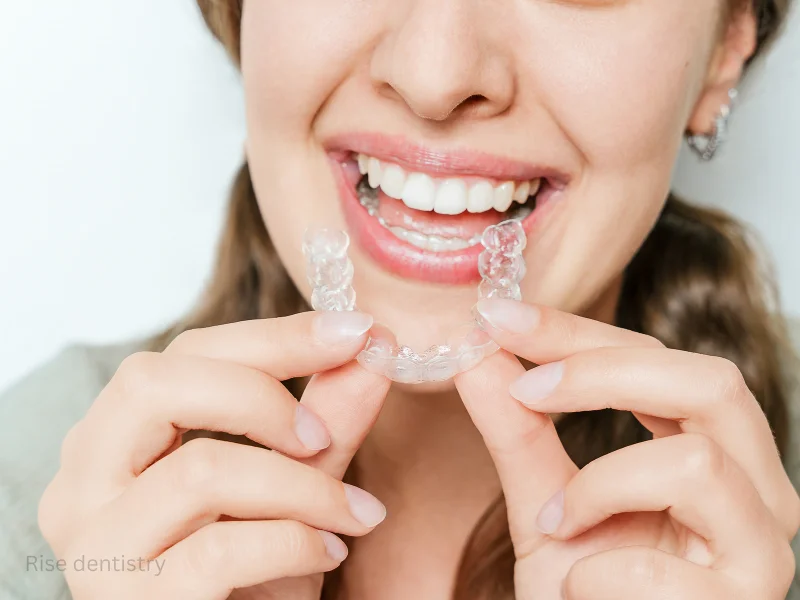 benefits of clear aligners for open bite correction