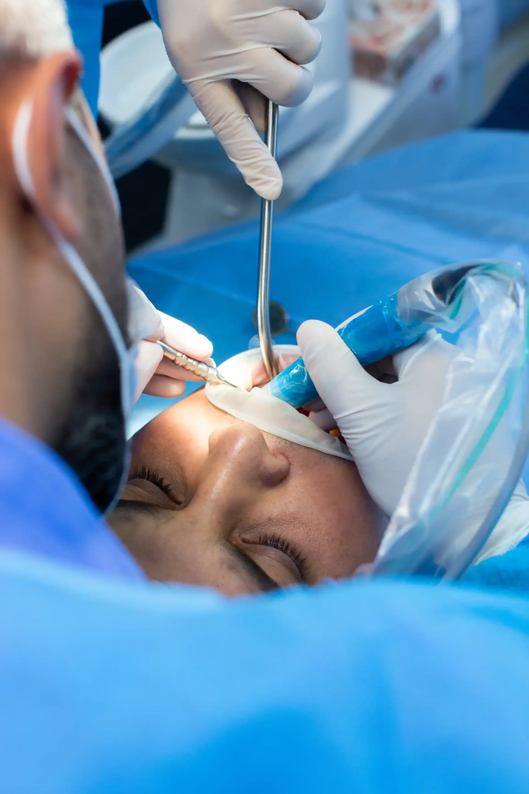 benefits of dental bonding
