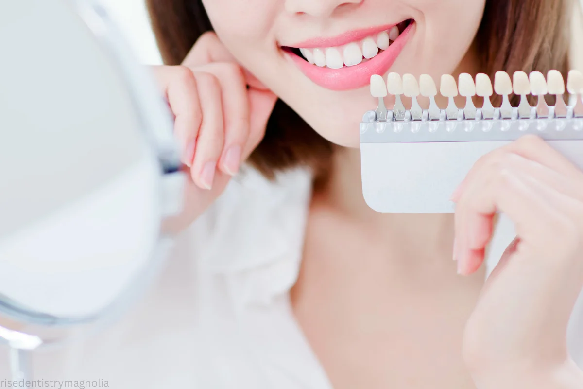 best time to whiten teeth