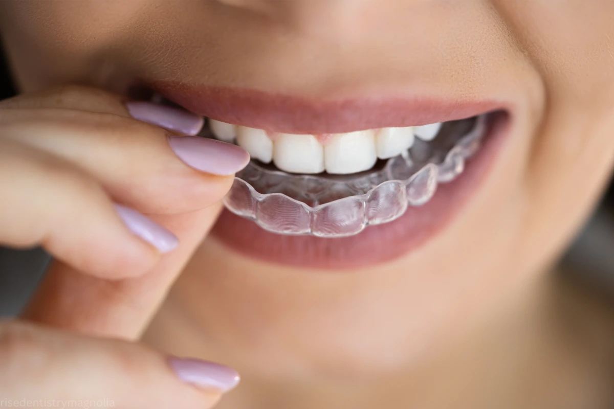 best way to straighten teeth
