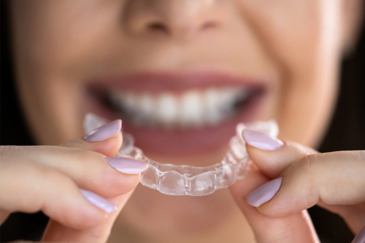clear aligners vs braces cost