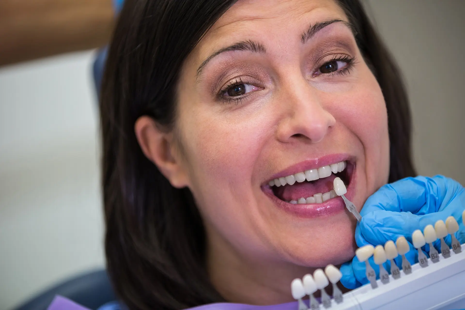dental bonding procedure