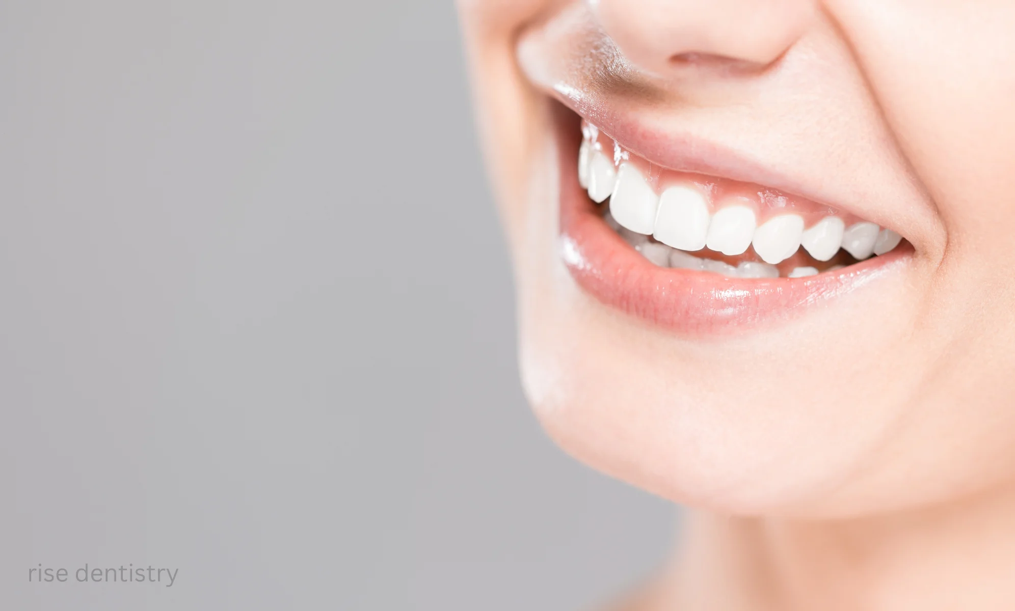 how long after teeth whitening can i eat normally