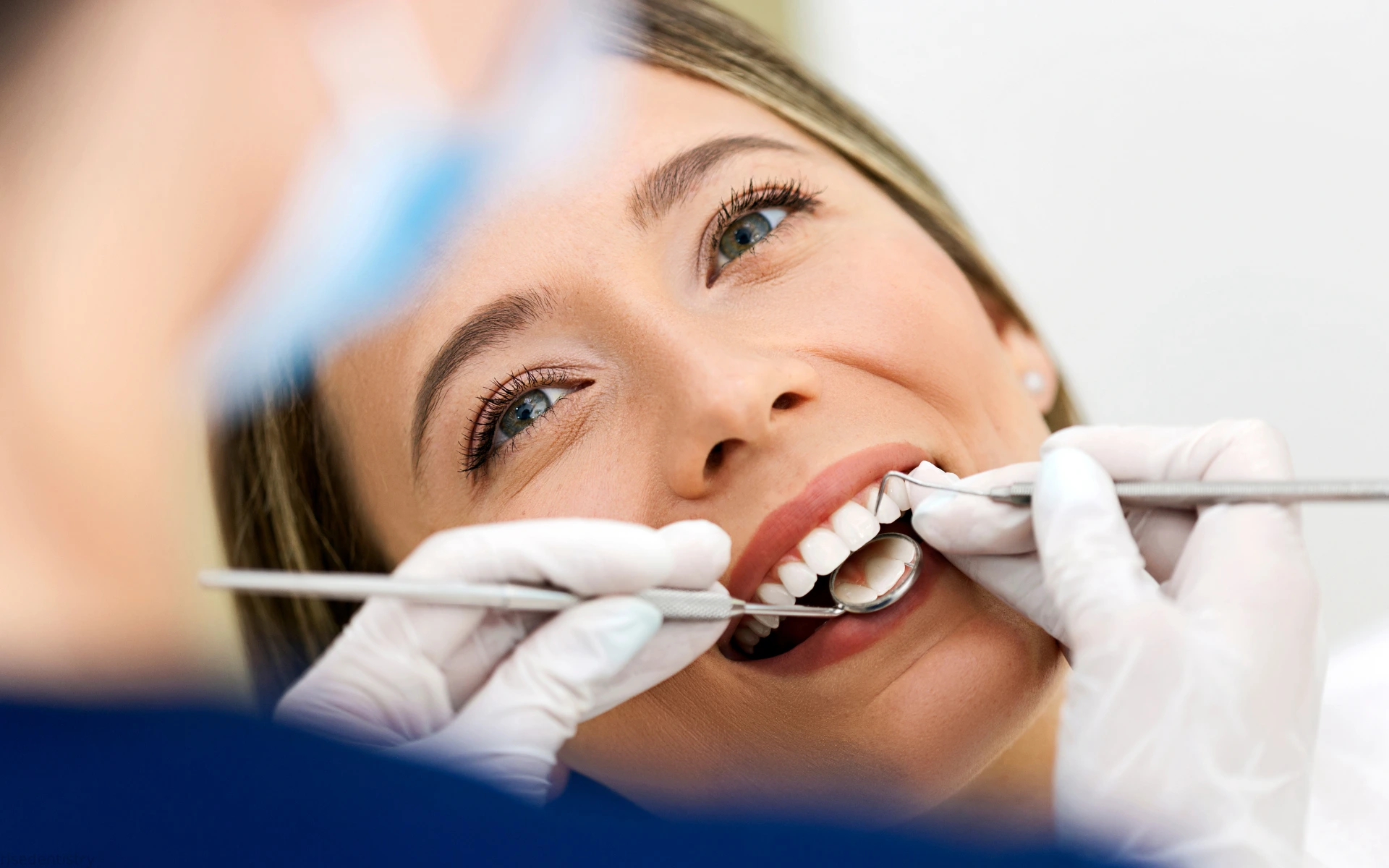 how much does teeth whitening cost
